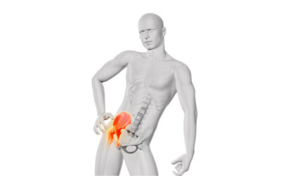 Why my hip doesn’t hurt anymore…