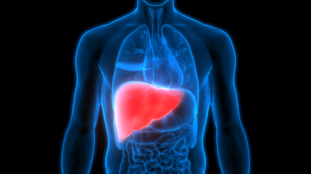 Understanding NAFLD: What It Is and How to Avoid It