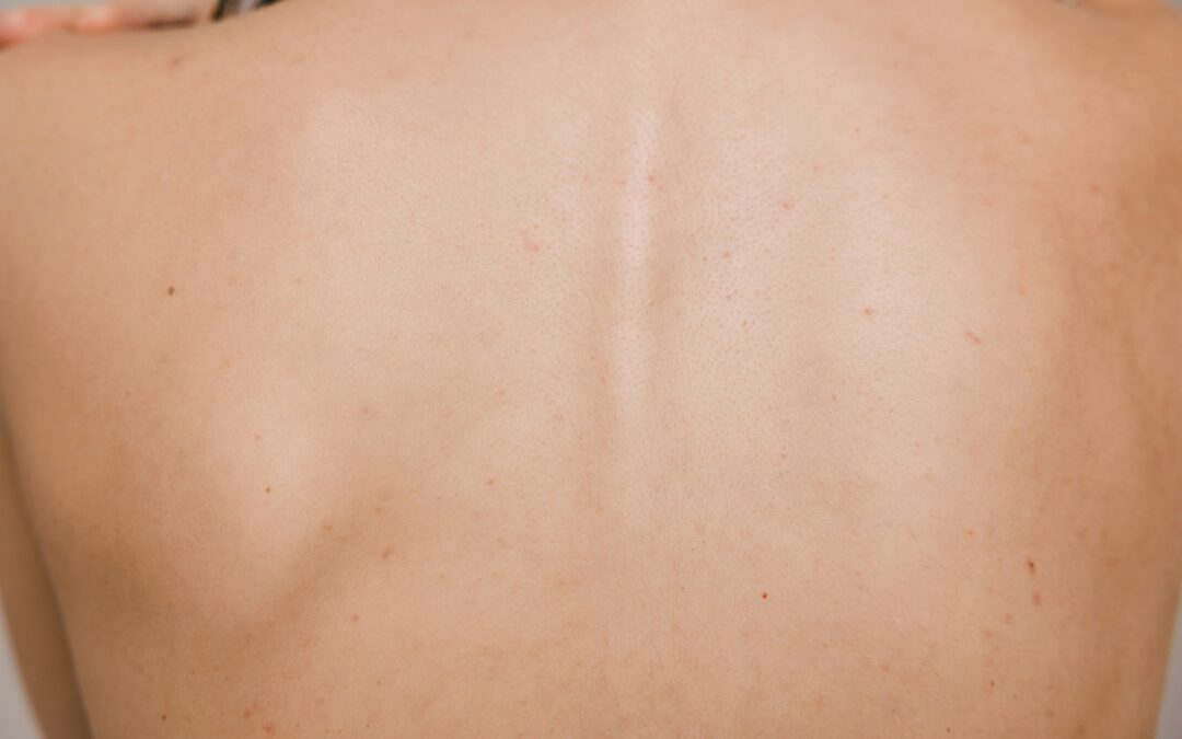 Skin tags, insulin and what your blood tests might be quietly telling you