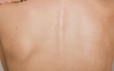 Skin tags, insulin and what your blood tests might be quietly telling you